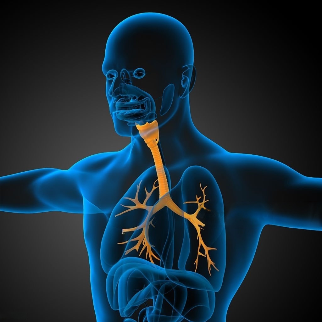 atresia esofagea neonatale